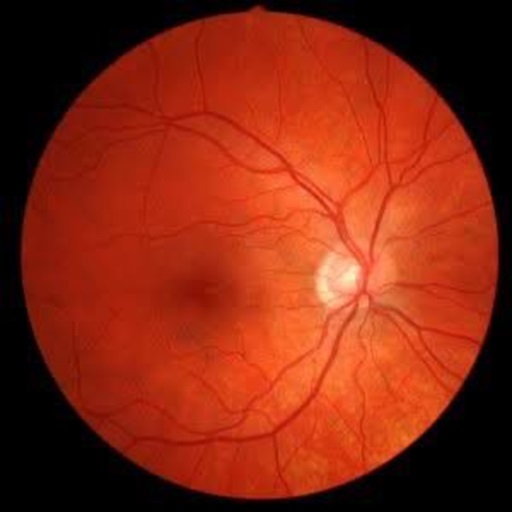 Refractive surgery